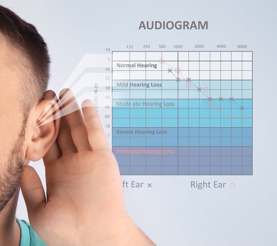 Audiogram