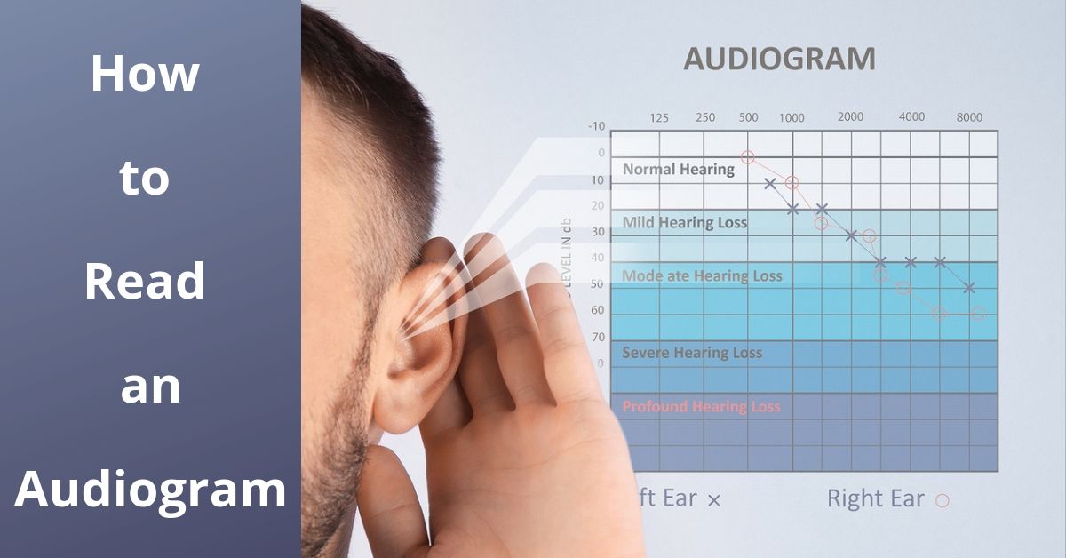 How To Read An Audiogram | Absolute Audio